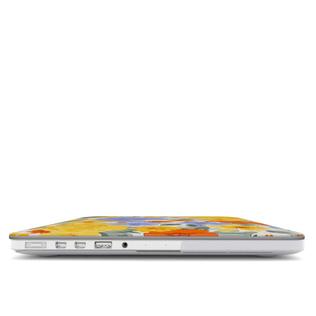 Electric Dreams Floral MacBook Case | Vibrant Hardshell Cover for MacBook Air and Pro