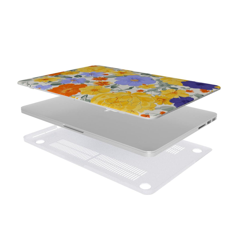 Electric Dreams Floral MacBook Case | Vibrant Hardshell Cover for MacBook Air and Pro